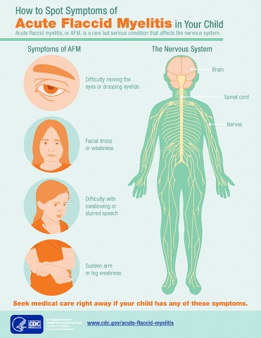 Acute Flaccid Myelitis Symptoms